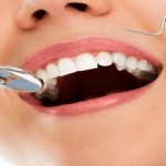 Θεραπεία με τοποθέτηση οδοντικών εμφυτευμάτων 